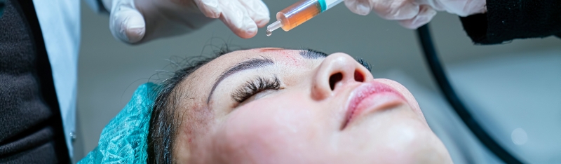 RF Microneedling skin renewal treatment explained professional insight