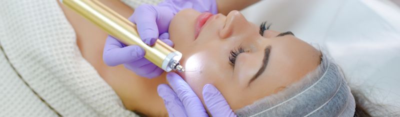 A woman battling low self-esteem due to a mole near her smile lines, finally regaining confidence through laser skin resurfacing.