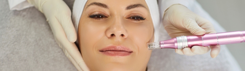 Dermapen microneedling service treatment showing precise collagen induction for smoother skin