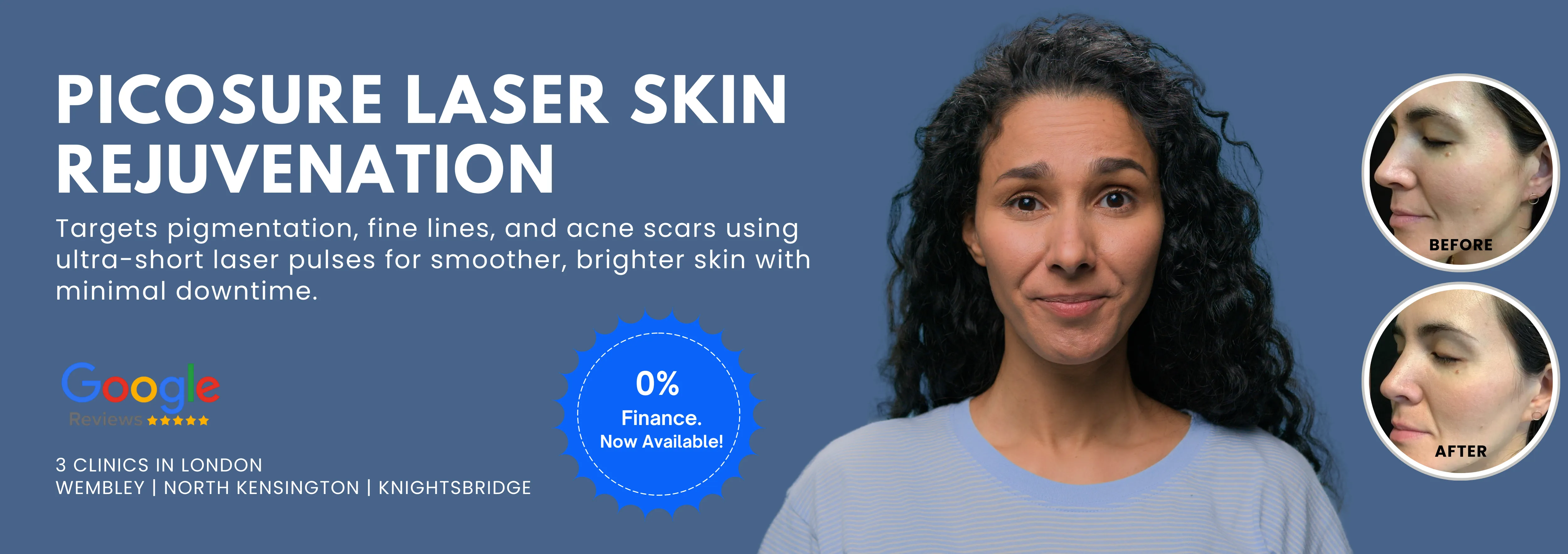 Picosure Laser Skin Rejuvenation