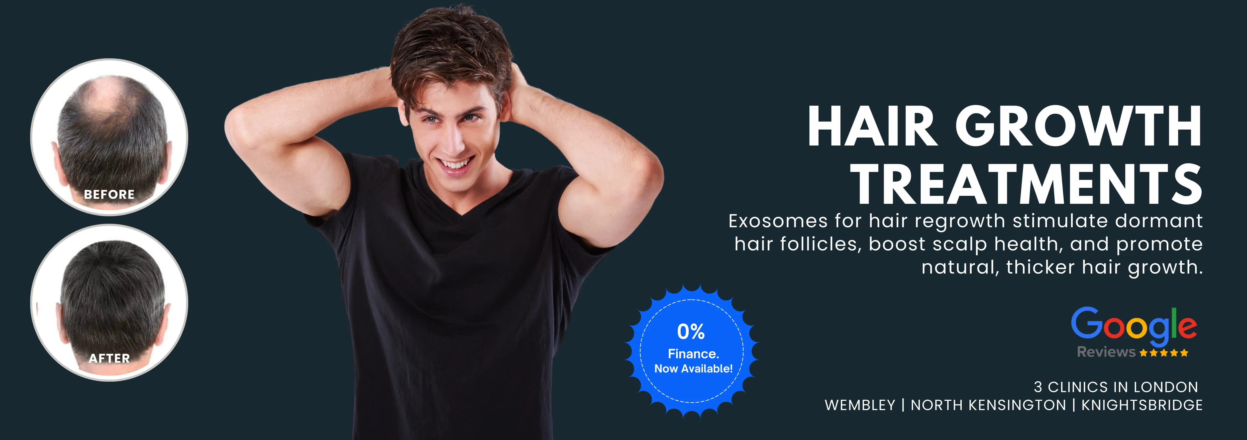 Hair Growth Treatments