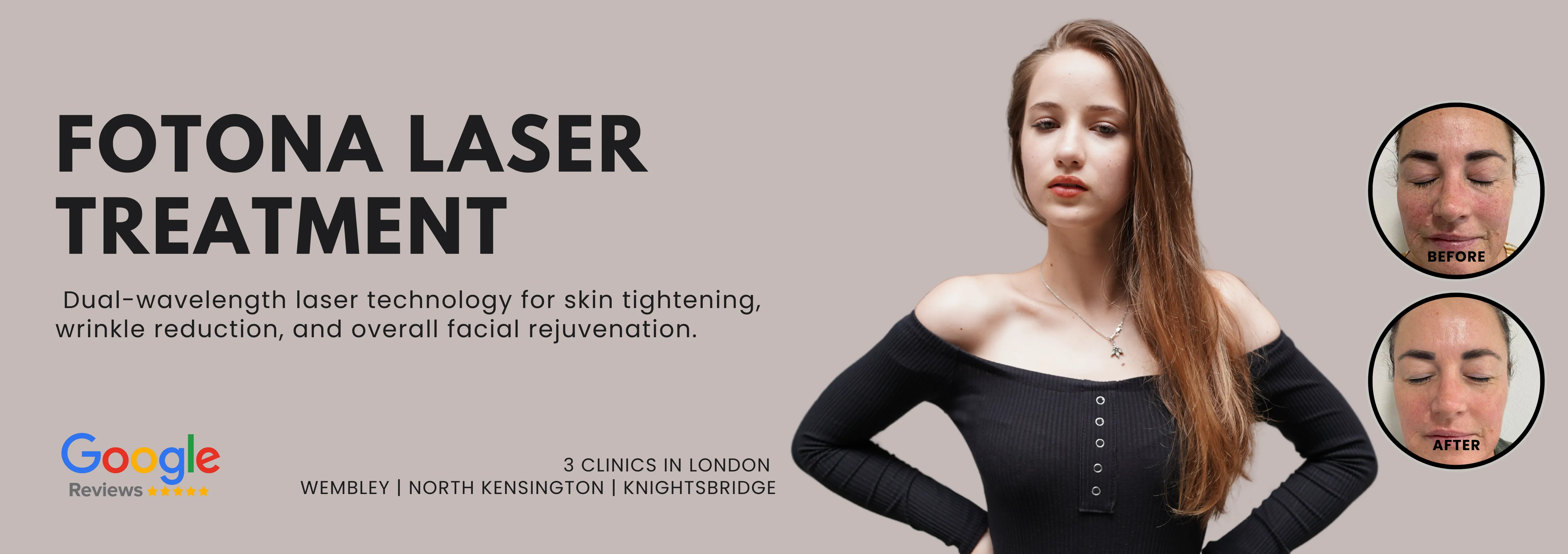 Fotona Laser Treatment