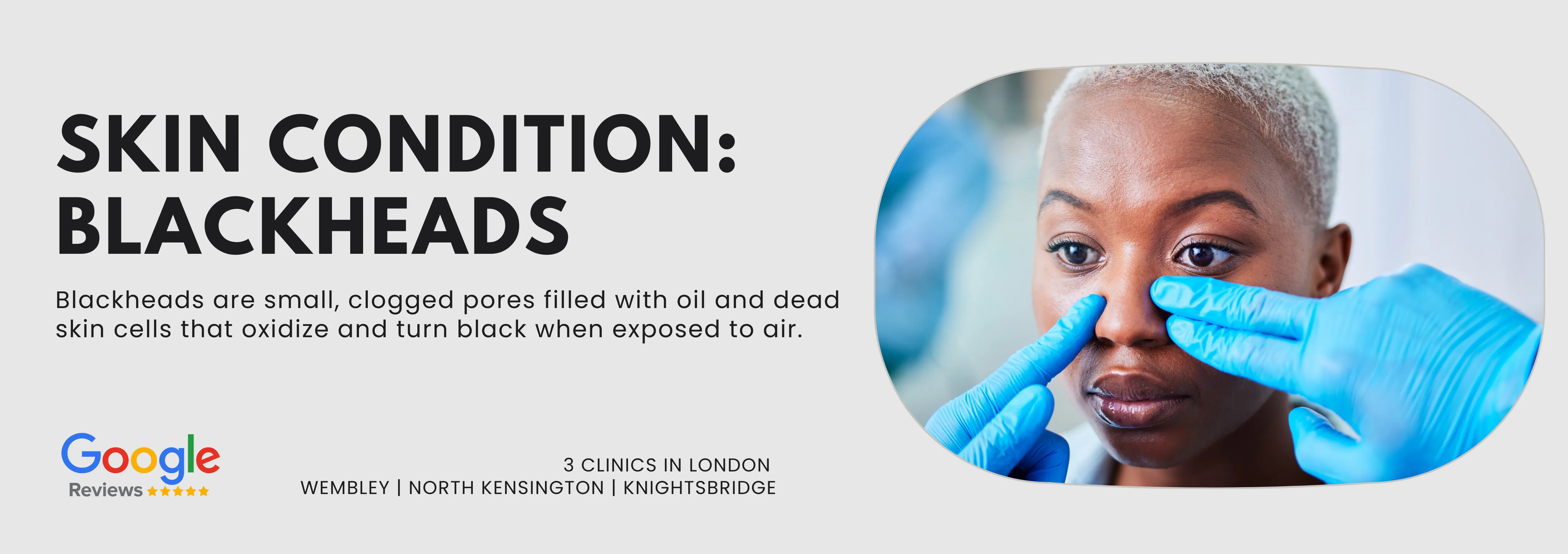 Blackheads Removal Clinic