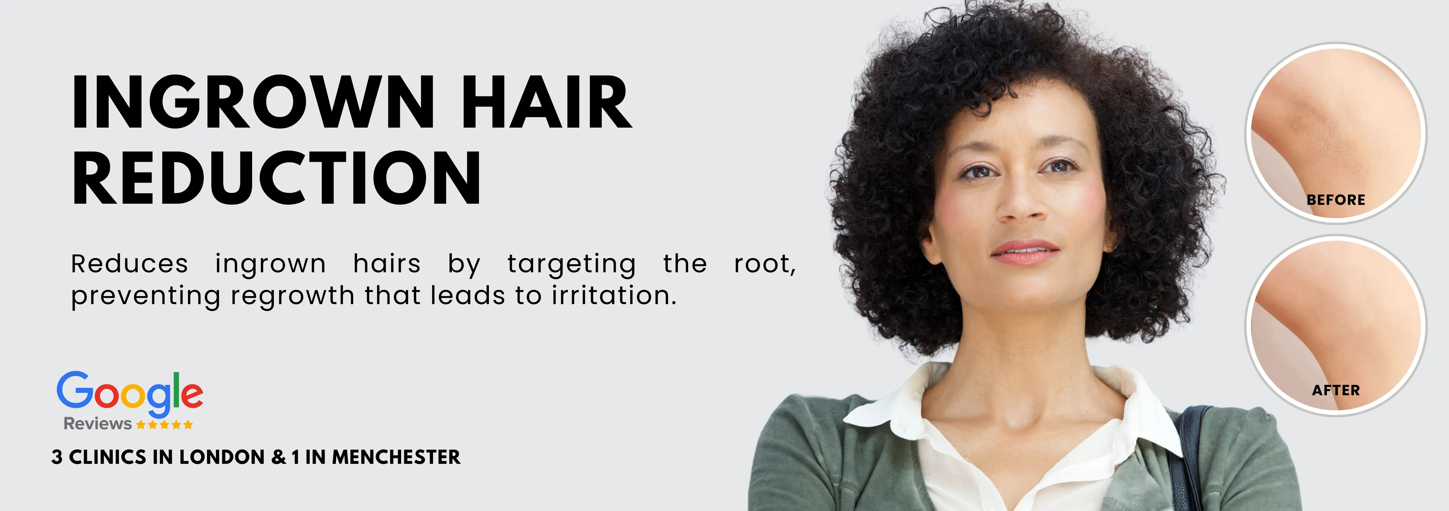 Ingrown Hair Removal