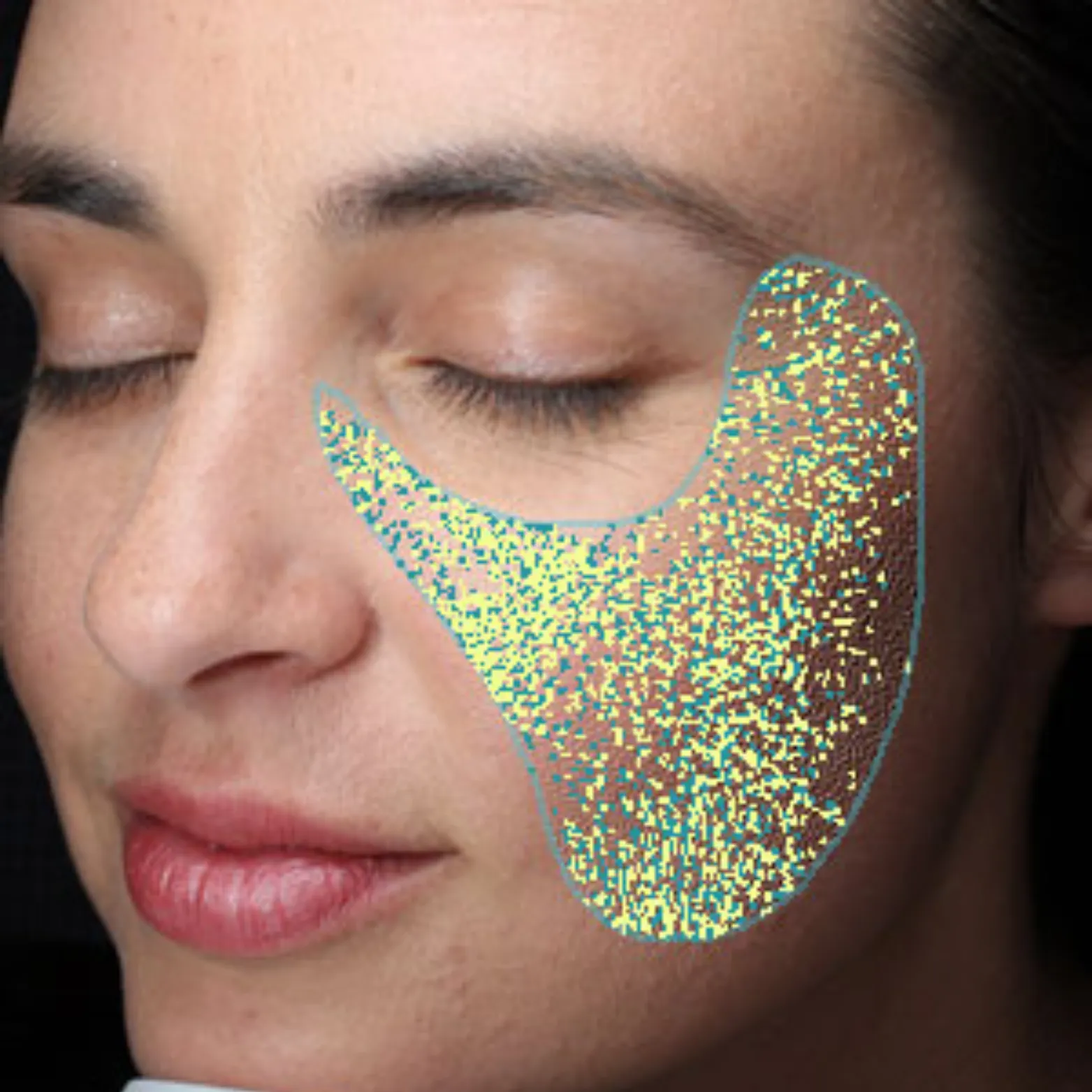 3D Skin Analysis