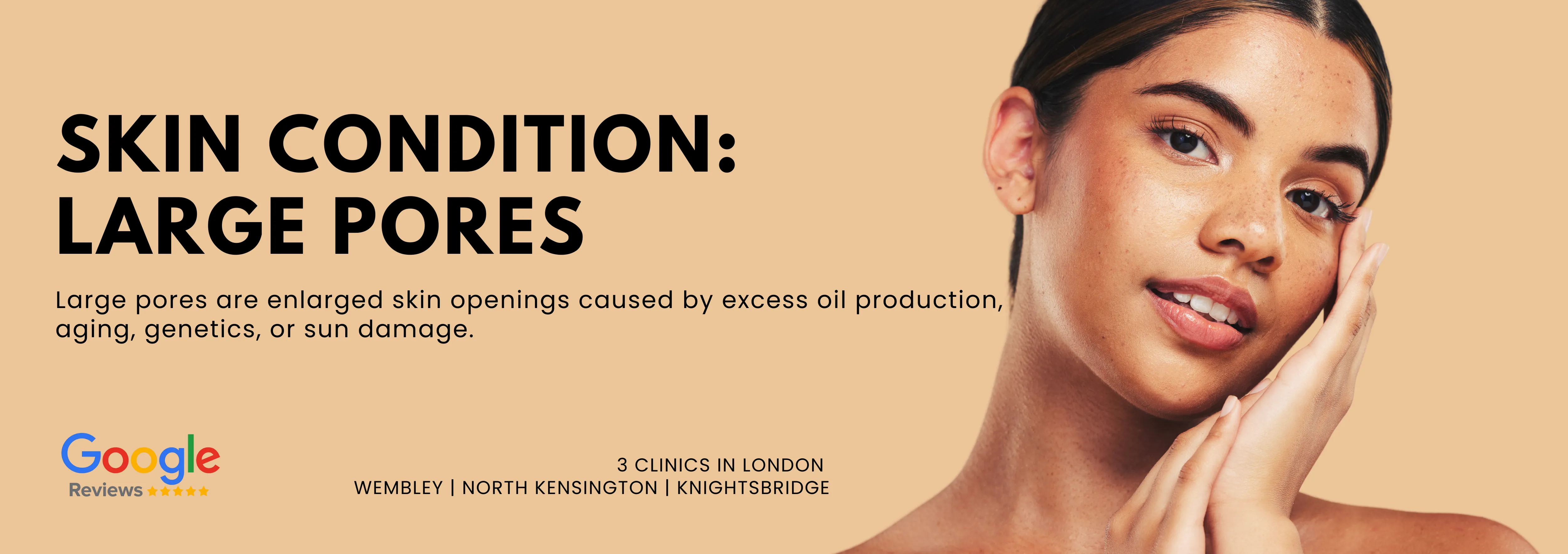 Enlarged Pores Treatments