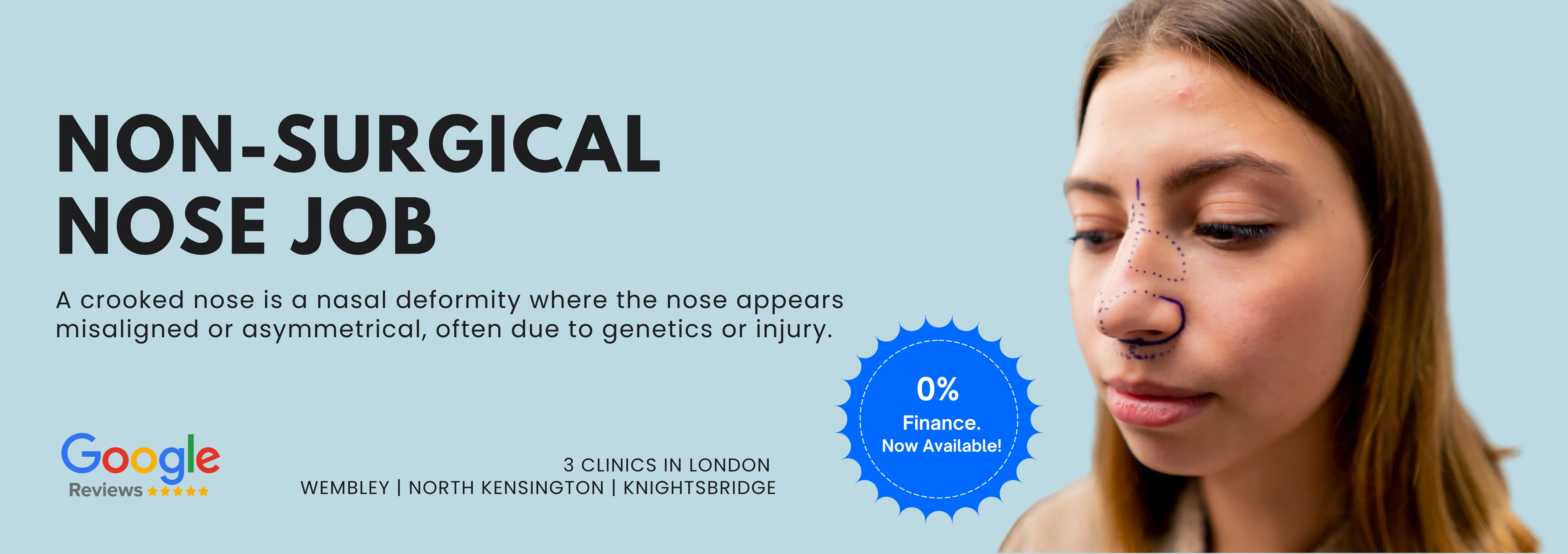 Non-Surgical Nose Job