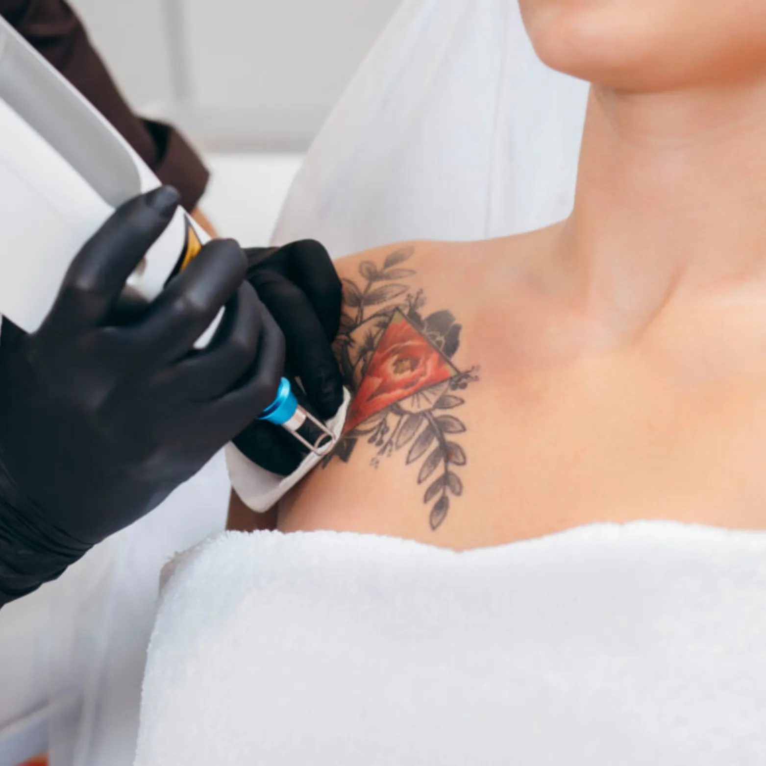 Post Tattoo Removal Revitalisation Package