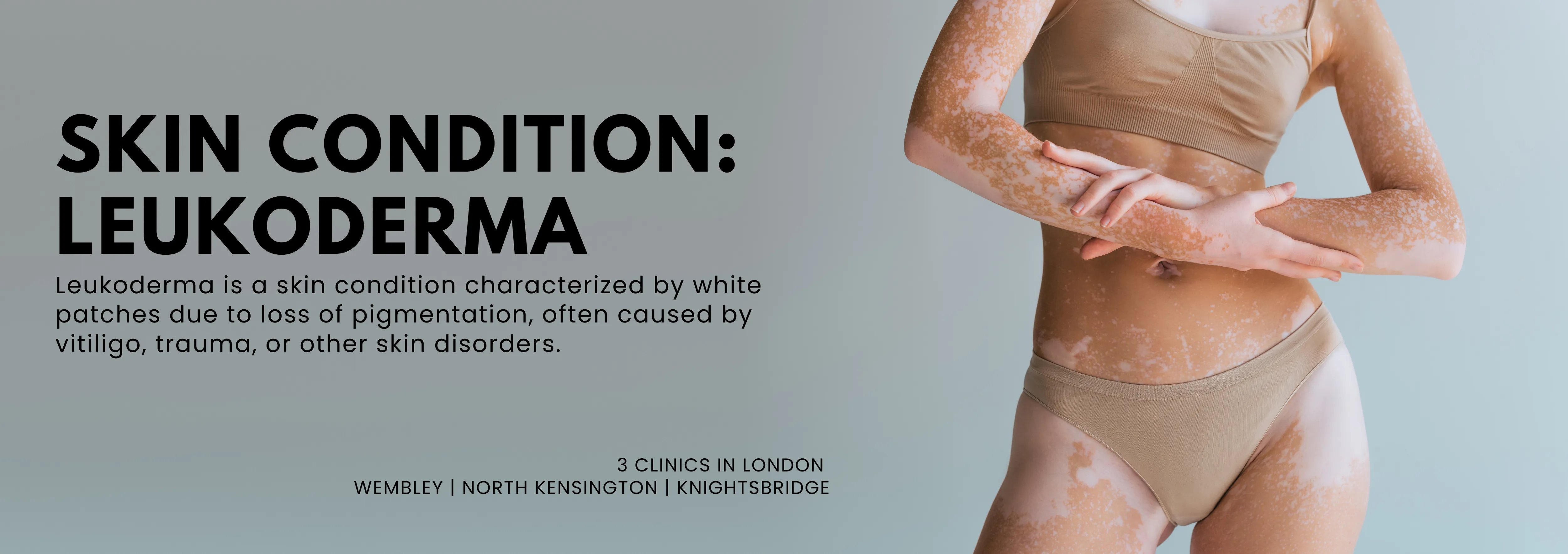 Leukoderma