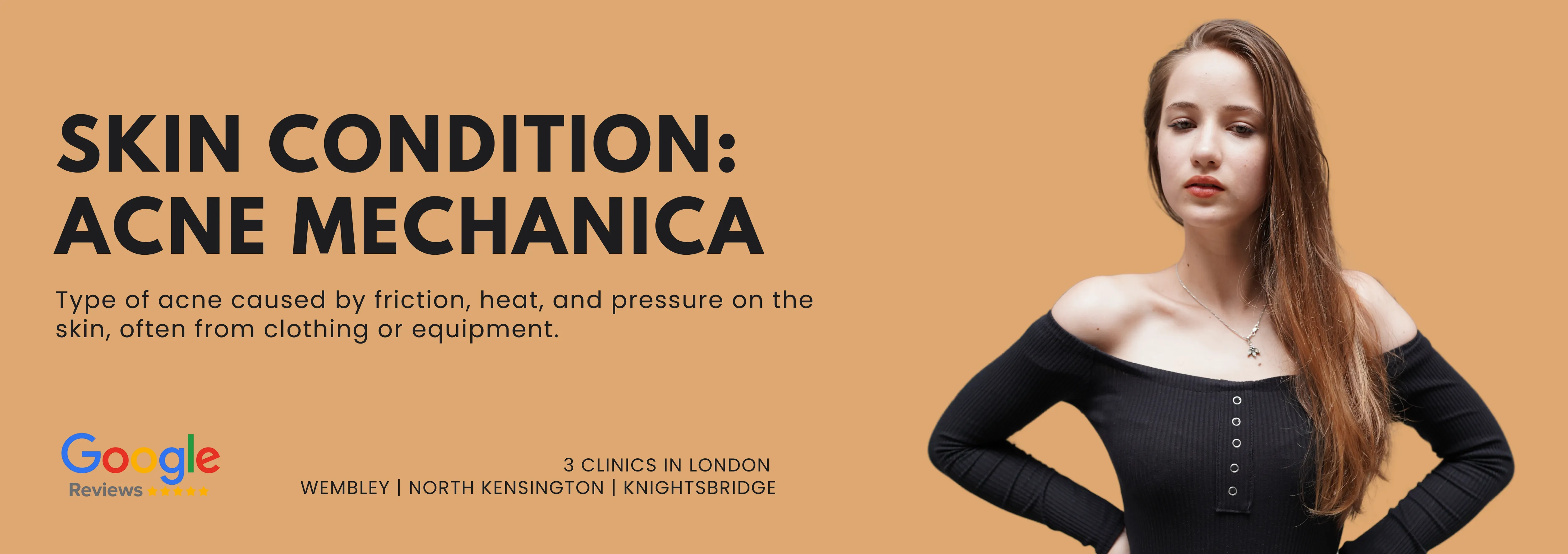 Acne Mechanica