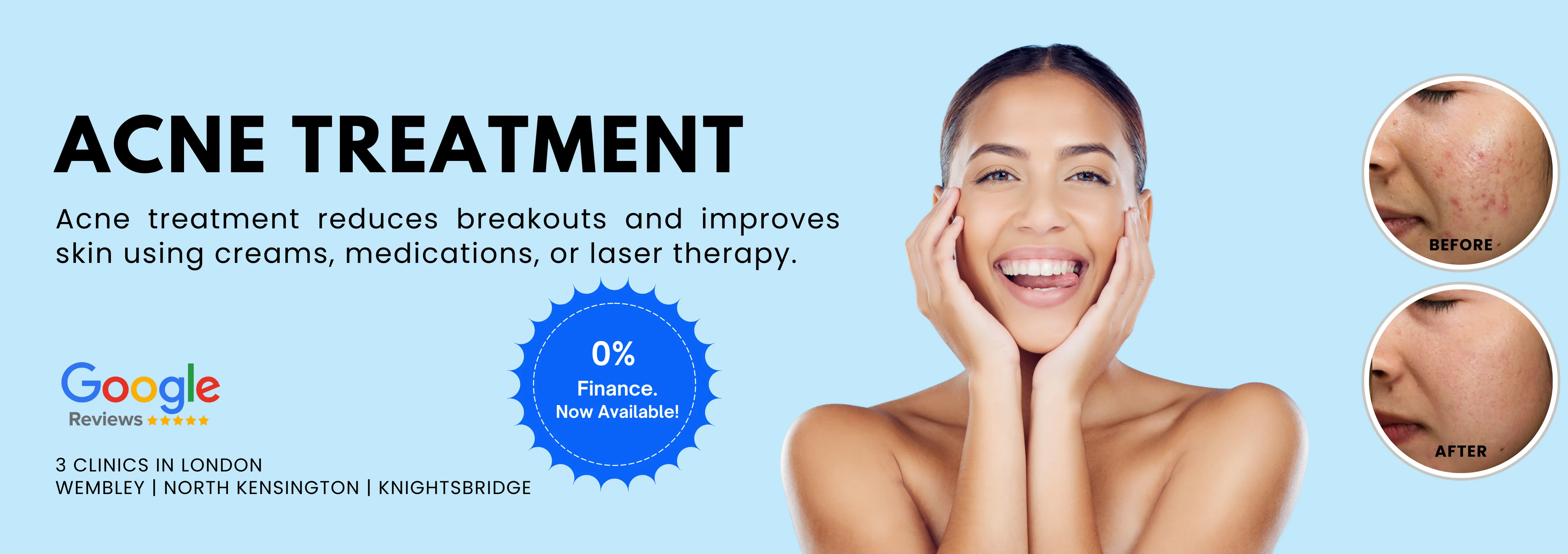 Acne Reduction Treatment